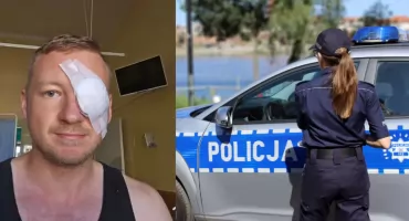 Metalowy przedmiot uderzył w motocyklistę w Toruniu. Lekarze walczą o jego oko