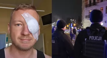 Koniec śledztwa ws. postrzelonego w Toruniu dziennikarza. Policja zabrała głos 